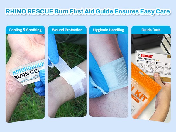 RHINO RESCUE Burn Kit with First Aid Burn Cream, Burn Dressing, Burn Gel