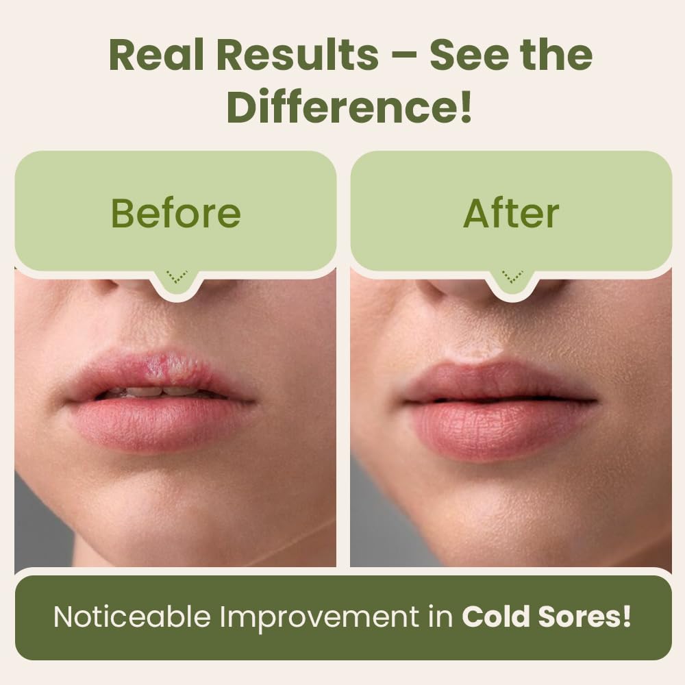 red-light-therapy-for-face-cold-sore-tre-5.jpg
