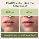 red-light-therapy-for-face-cold-sore-tre-5.jpg
