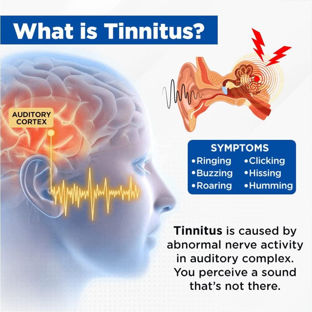 acupeace-tinnitus-relief-device-auricalm-3.jpg