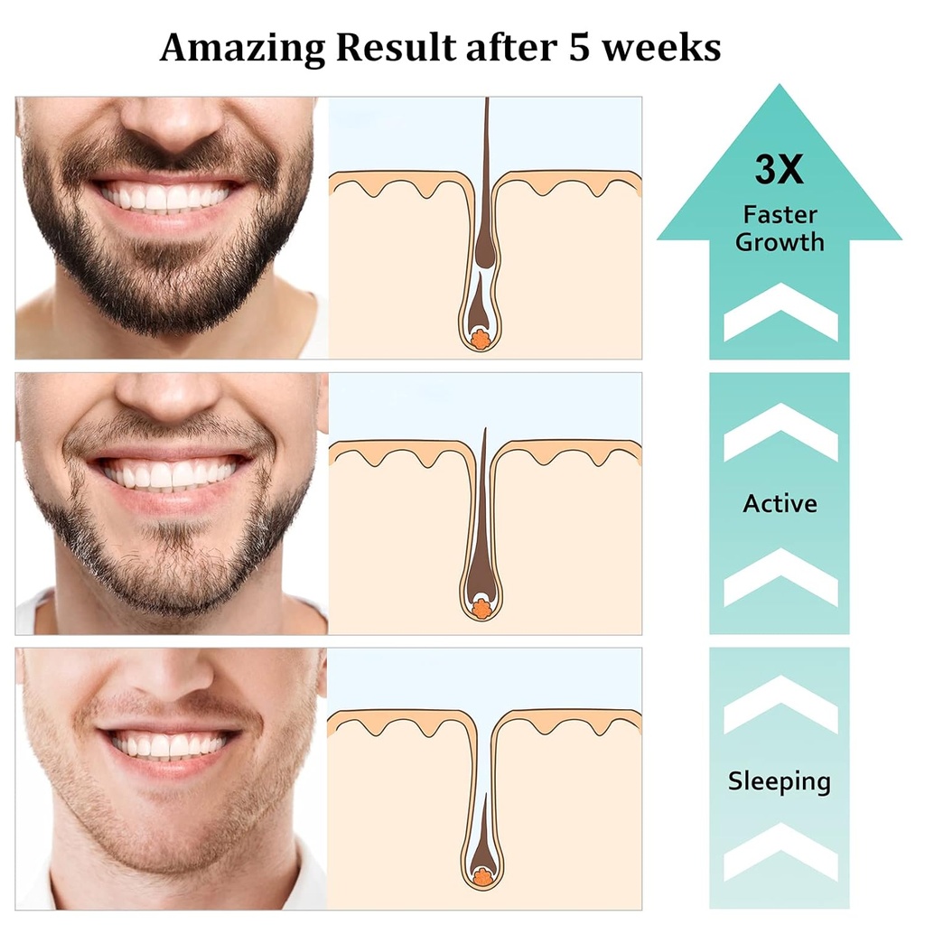raffin-beard-growth-kit-upgraded-beard-g-5.jpg