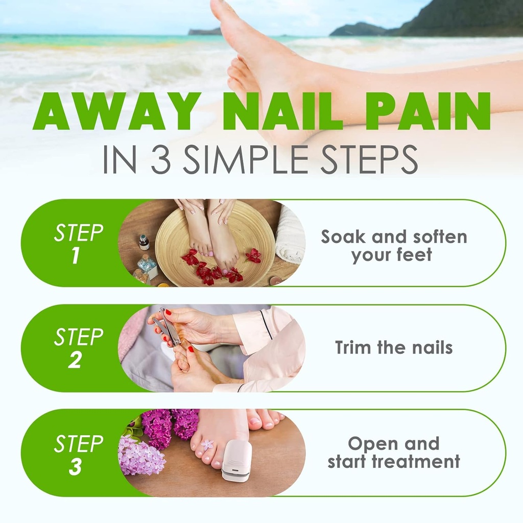 nail-fungus-light-for-toenails-highly-ef-4.jpg