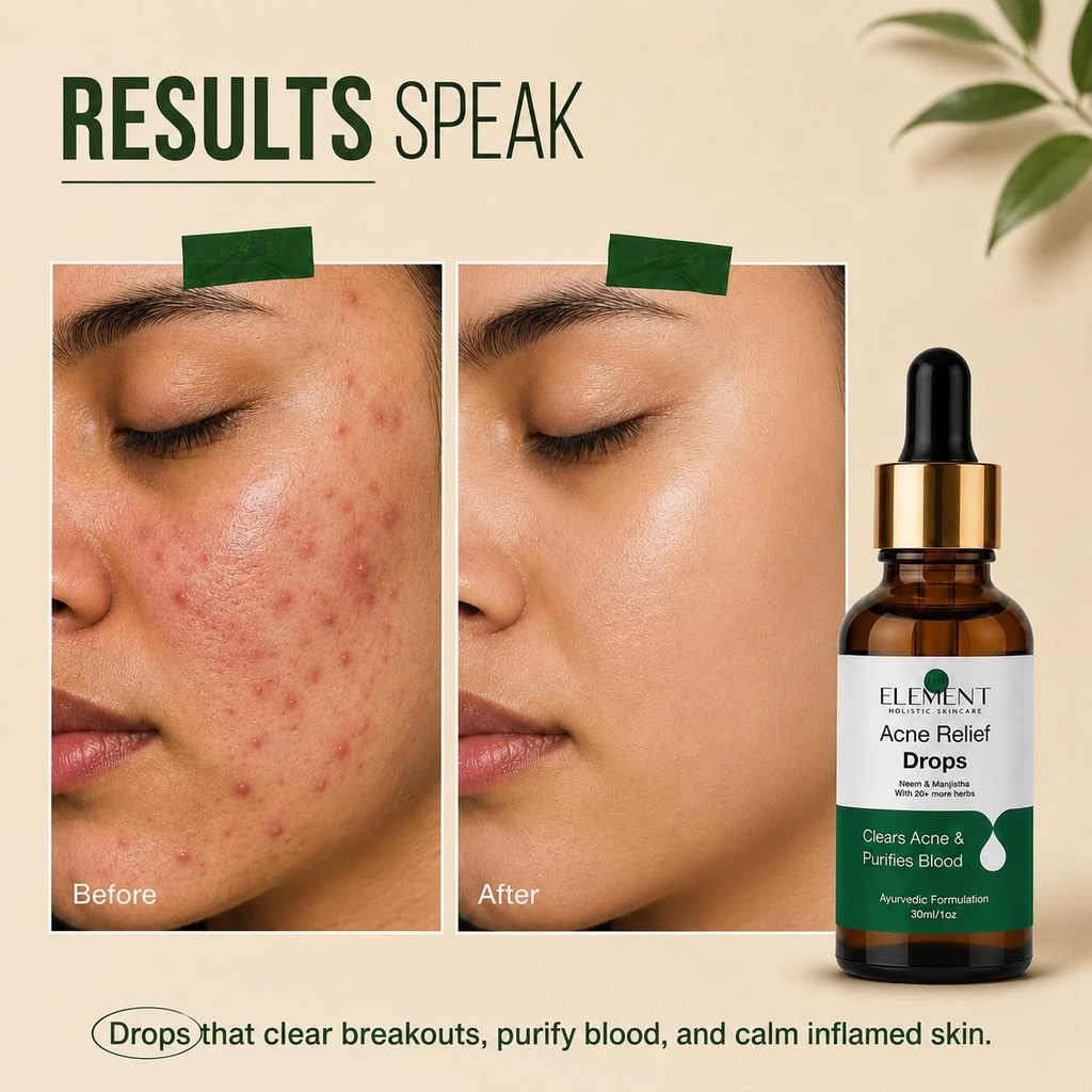 the-element-acne-relief-drops-drinkable--71hGS0bY3NL.jpg