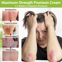 psoriasis-cream-maximum-strength-treatme-2.jpg