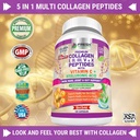 fresh-healthcare-elderberry-immune-suppo-4.jpg
