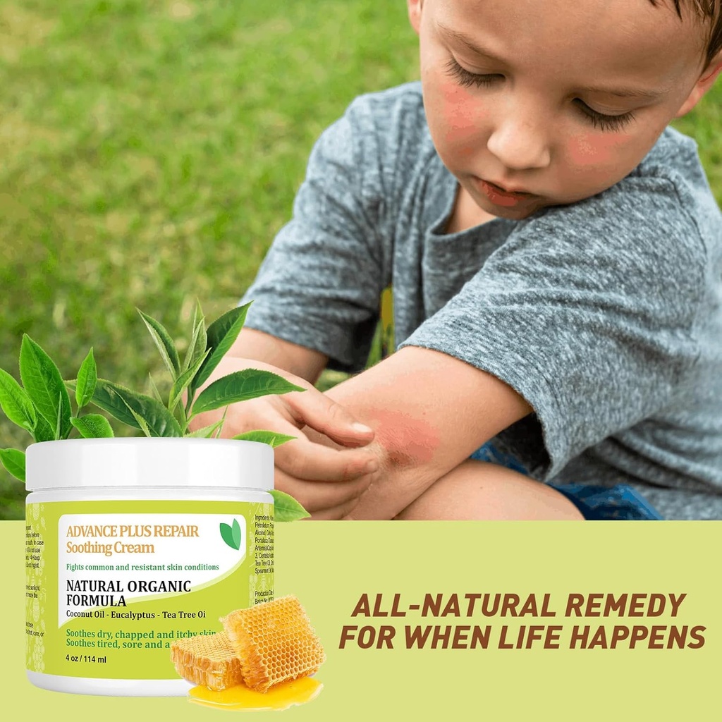 heat-rash-cream-with-organic-manuka-hone-5.jpg
