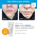 clinically-tested-dermacalm-sos-therapy--4.jpg