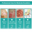 dimora-hydrocolloid-dressing-4-x-4-for-w-5.jpg
