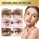 hyaluronic-acid-eye-patch-removes-dark-c-3.jpg