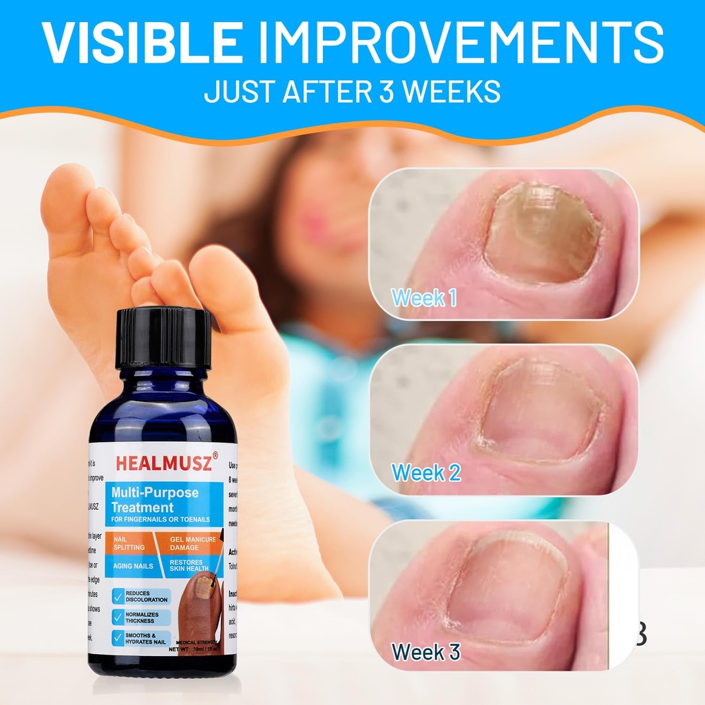 toenail-fungus-treatmenttoe-fungus-nail--6.jpg