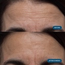 elemis-pro-collagen-skin-future-suppleme-3.jpg