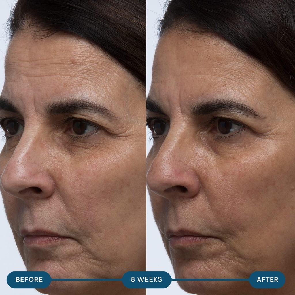 elemis-pro-collagen-skin-future-suppleme-4.jpg