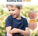 yarkor-bug-bite-suction-tool-3-packs-kid-3.jpg