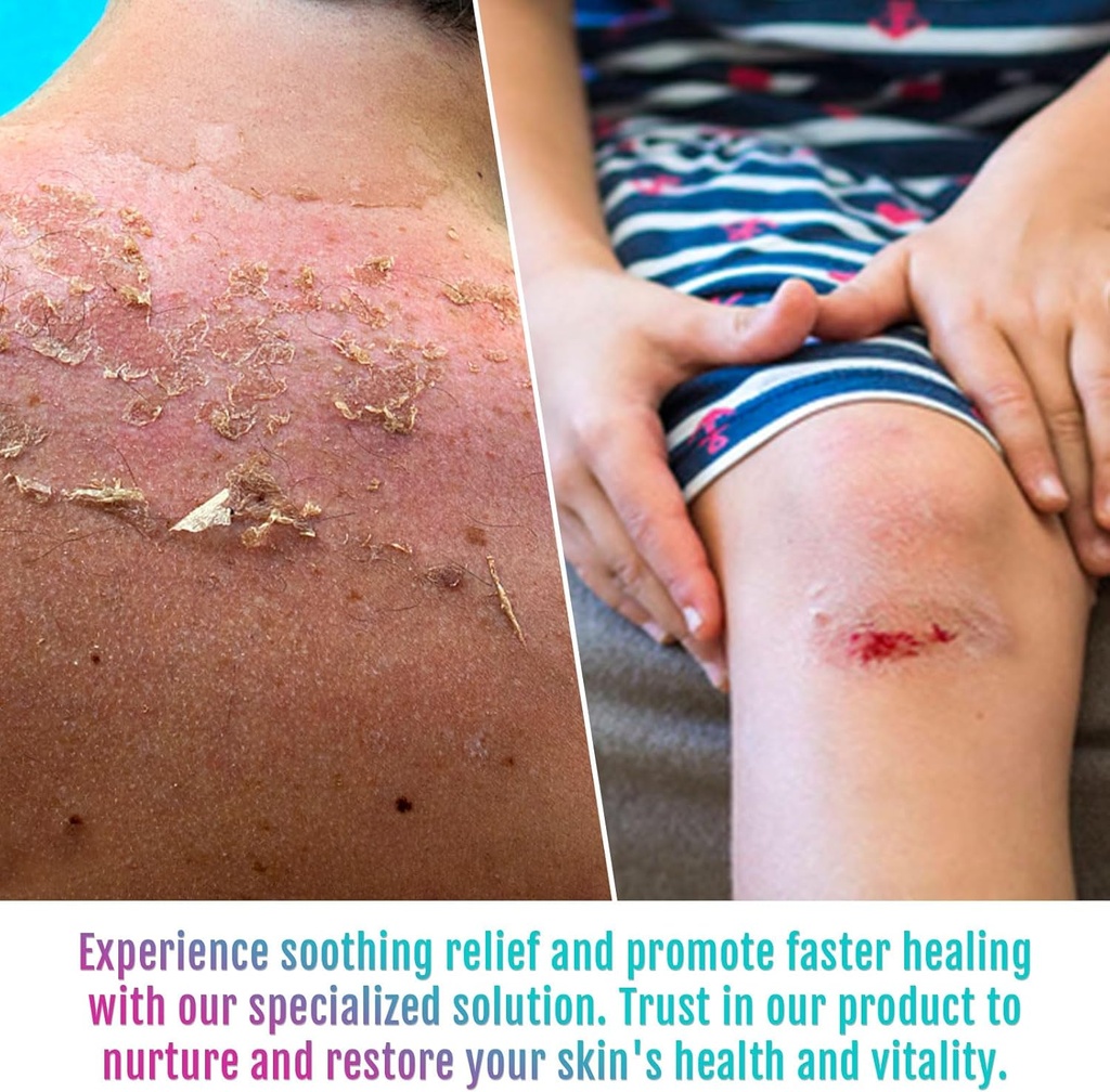 manuka-honey-5x-accelerated-healing-reli-3.jpg