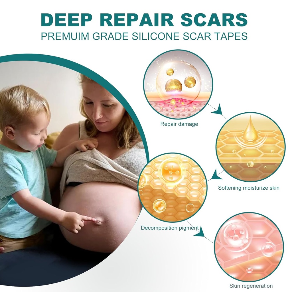 silicone-scar-sheets-16x-158-roll-4m-sil-3.jpg