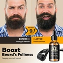 waking-forest-derma-roller-025mm-beard-o-2.jpg
