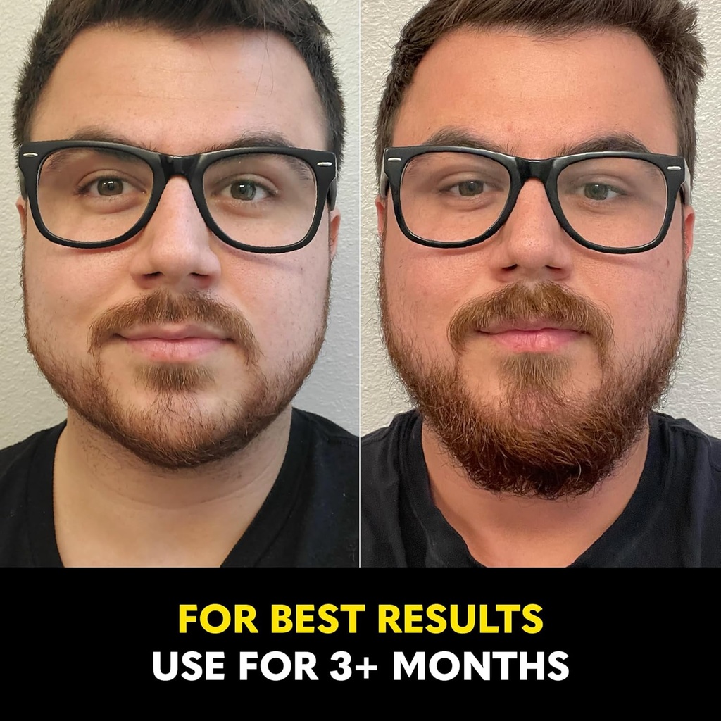 the-beard-club---biotin-beard-growth-vit-6.jpg