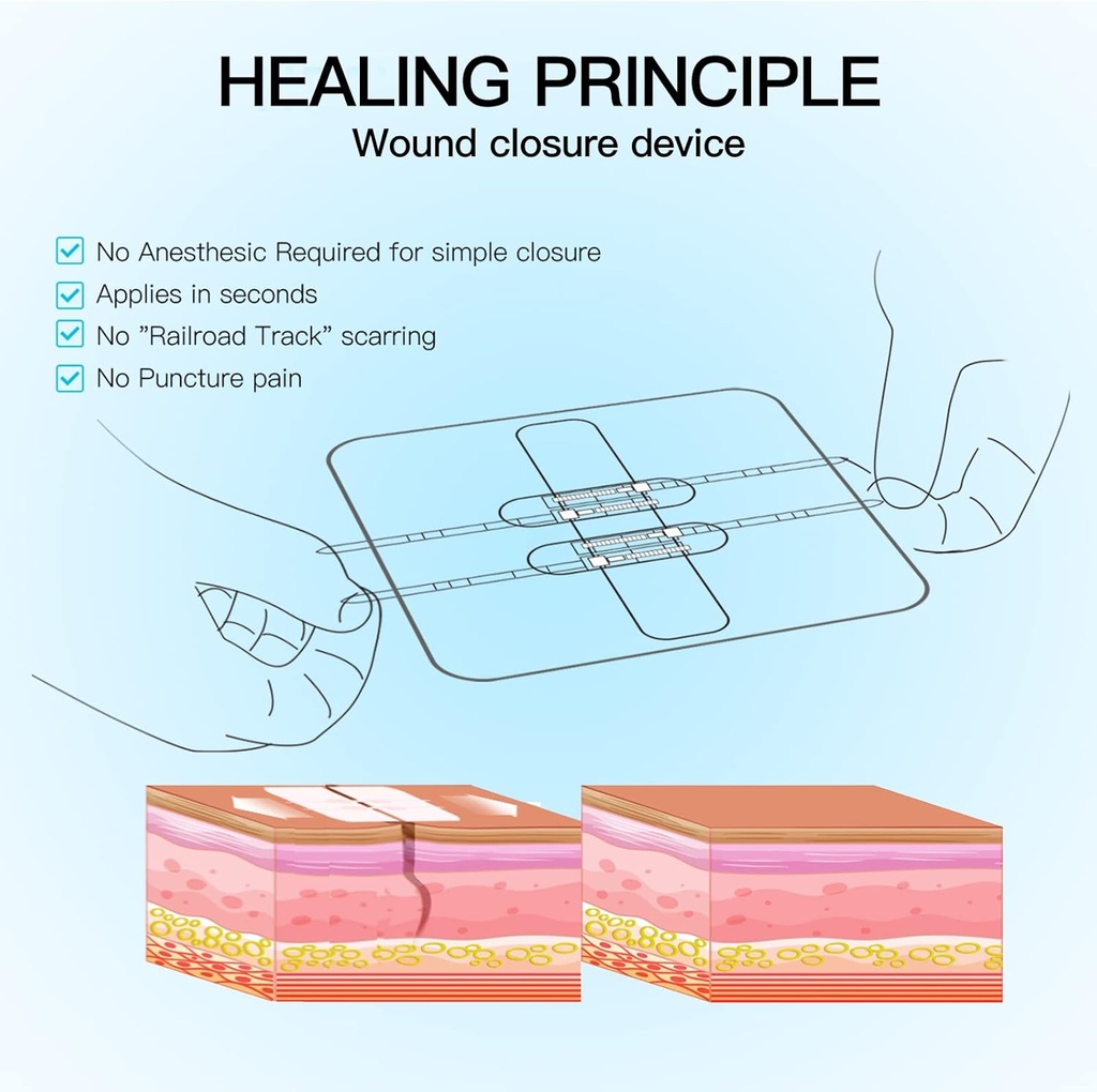 zip-stitch-laceration-repair-without-sti-4.jpg
