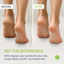 truremedy-naturals-remedy-balm-with-tea--4.jpg