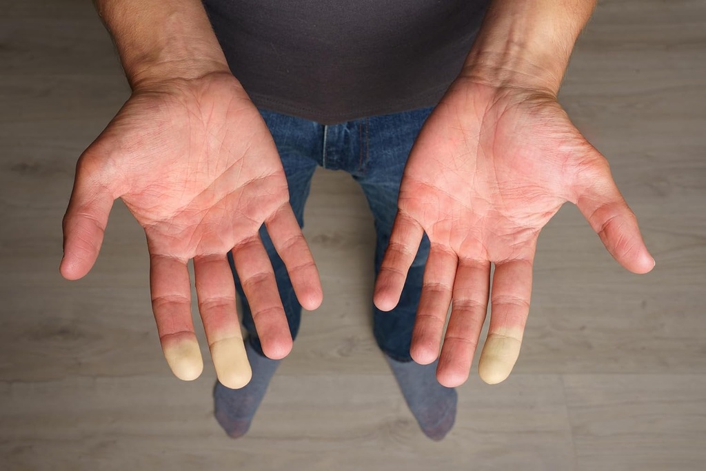 extremity-warmth---for-cold-hands-and-fe-5.jpg
