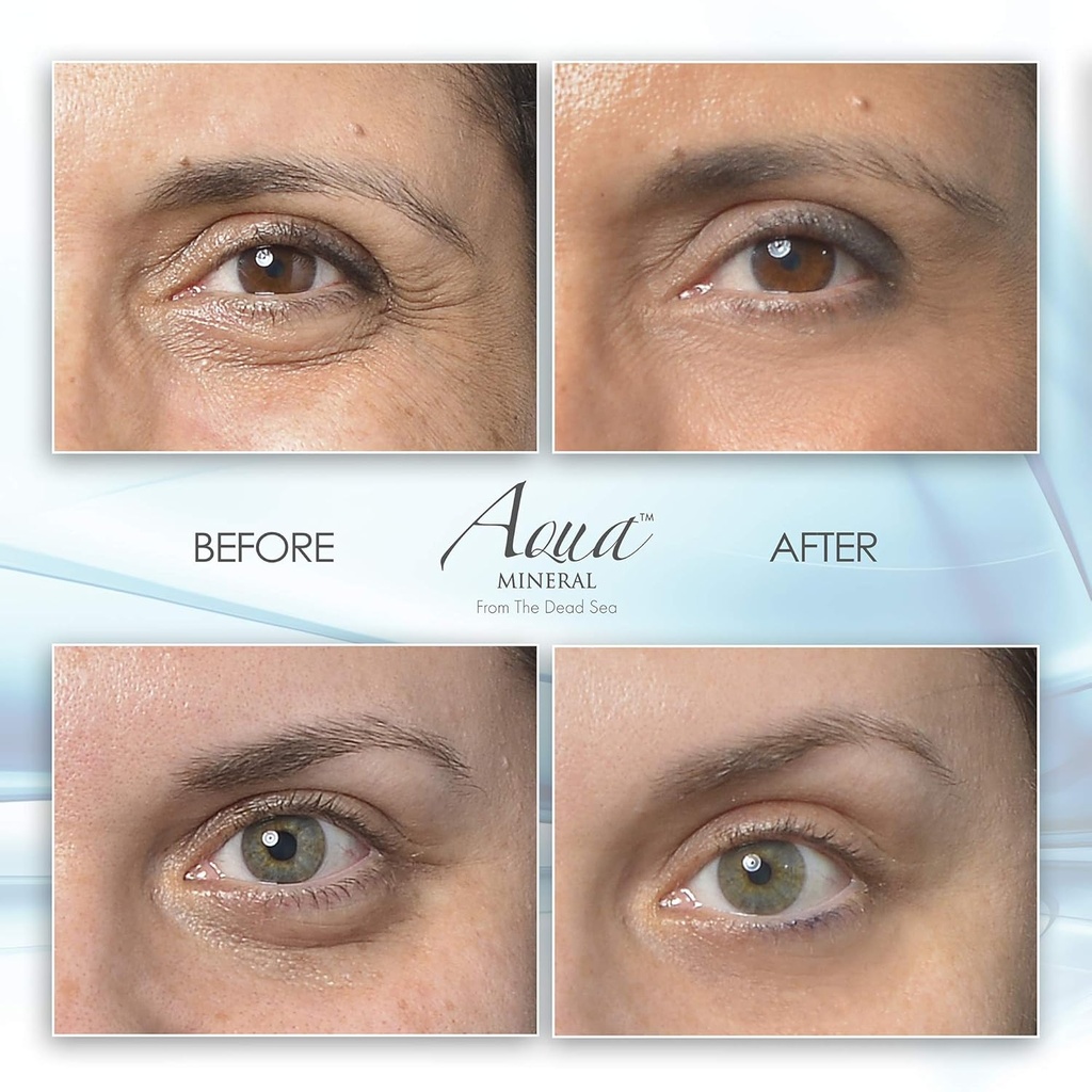 puffy-eye-gel-instant-results-naturally--3.jpg