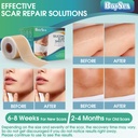 professional-silicone-scar-sheets-1-6-x--5.jpg