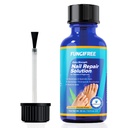 Toenail Pilzbehandlung extra Stärke - Nagelpilzbehandlung für Zehenail - Zehennagel Pilzbehandlung extra Stärke - Nagelpilzbehandlung (30ml)