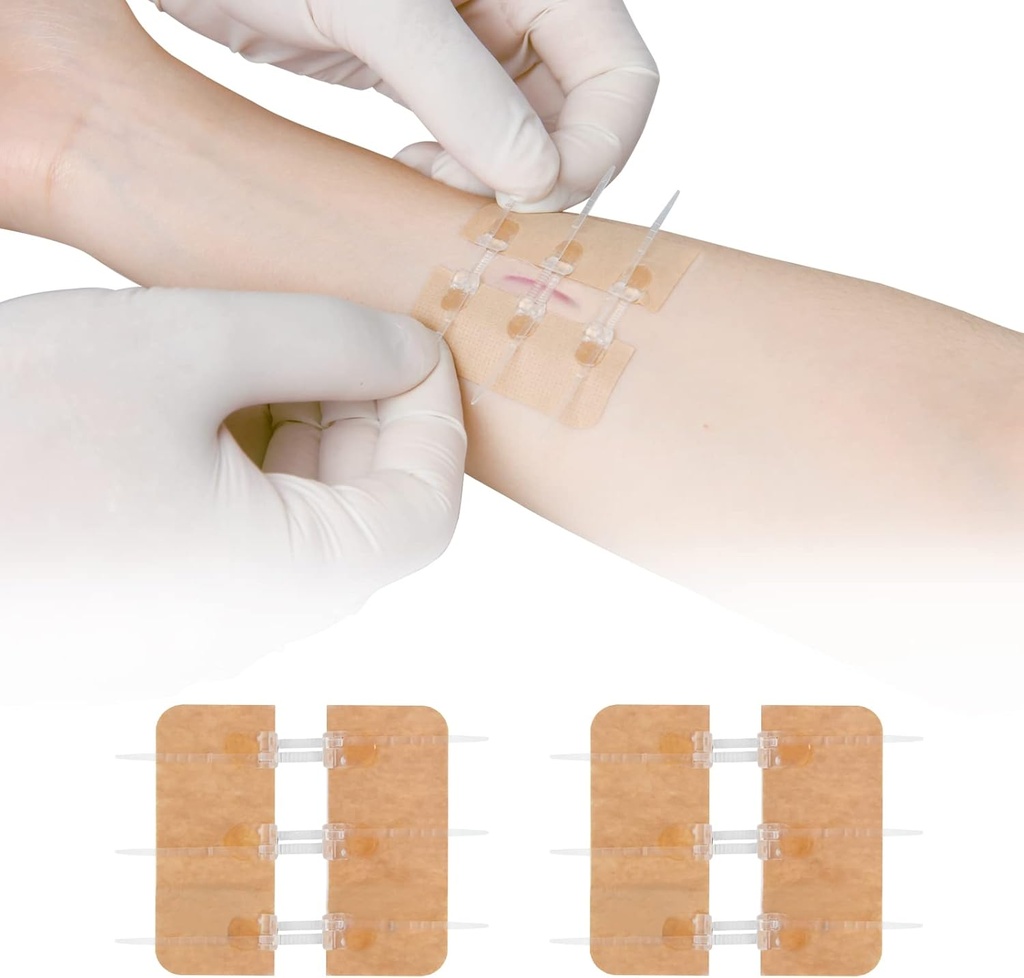 Zip Stitch Schnürung Reparatur ohne Stitches Butterfly Bandaids Quick Clot - Notfall Wound Schließungen Gerät 2 Stück(PU)