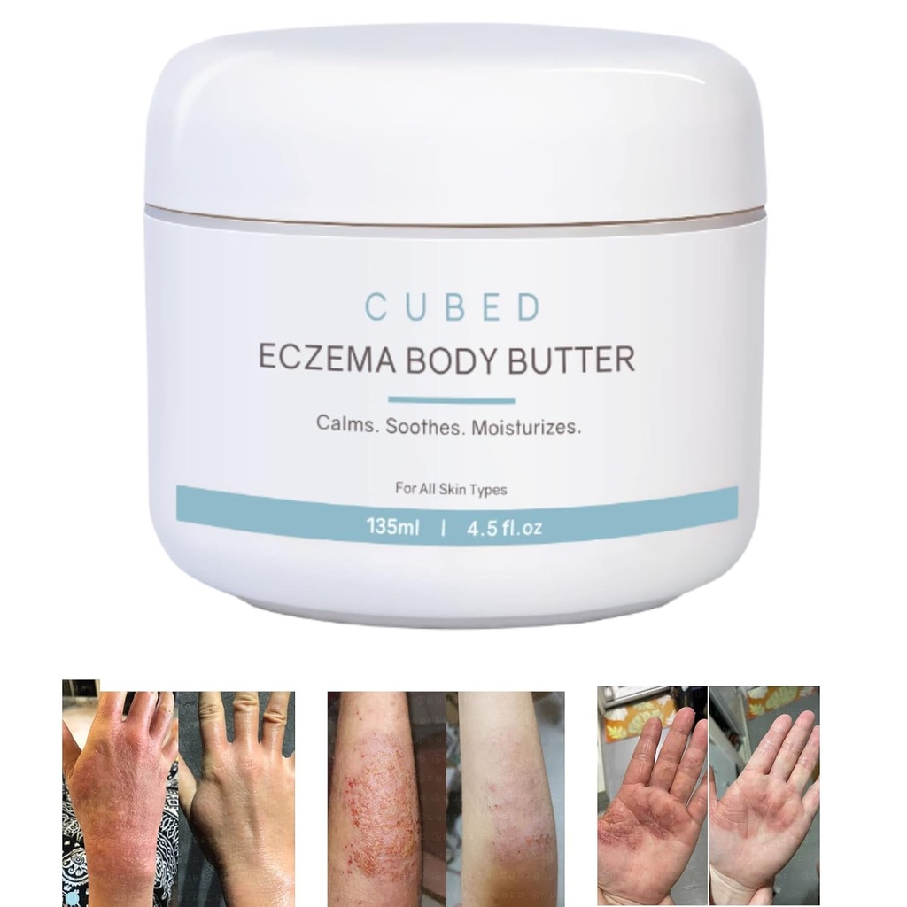 Cubed 4.5 oz Eczema Cream für Erwachsene, Eczema Relief, Eczema Behandlung, Moisturize Dry Irridated Skin, Smart Lotion für topische Steroid-Entnahme Symptome, Psoriasis & Rosacea, Eczema, Dermatitis