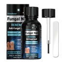 Traitement des champignons des ongles, traitement des champignons des ongles pour les ongles, solution de réparation des ongles, renouvellement des ongles liquides pour les ongles endommagés et décoloration, traitement des champignons des ongles, en toute sécurité et délicatement - 30ML (1 FLOZ)
