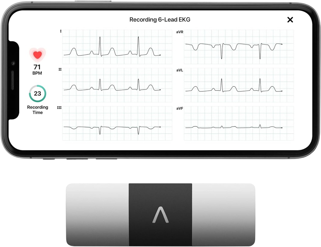 AliveCor KardiaMobile 6-Lead Personal EKG Monitor – Sechs Ansichten des Herzens – Erkennt AFib und unregelmäßige Arrhythmien – Instant Results in 30 Sekunden – arbeitet mit den meisten Smartphones