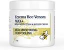 High Strength Bee Venom Cream, Dyshidrotic Eczema Ointment, Heat Rash, Itching, Eczema, Psoriasis, Leg, Stomach, Fuß, Hand, Irritated Skin, All Age Care