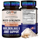faire pousser la vitamine Multi Collagène Capsules 1800MG (Types I, II, III, V & X) - Non OGM, Collagène herbeux - Anti Vieillissement Support pour les cheveux, la peau, les ongles - Pilules protéiques pour le soutien articulaire - 90 Capsules
